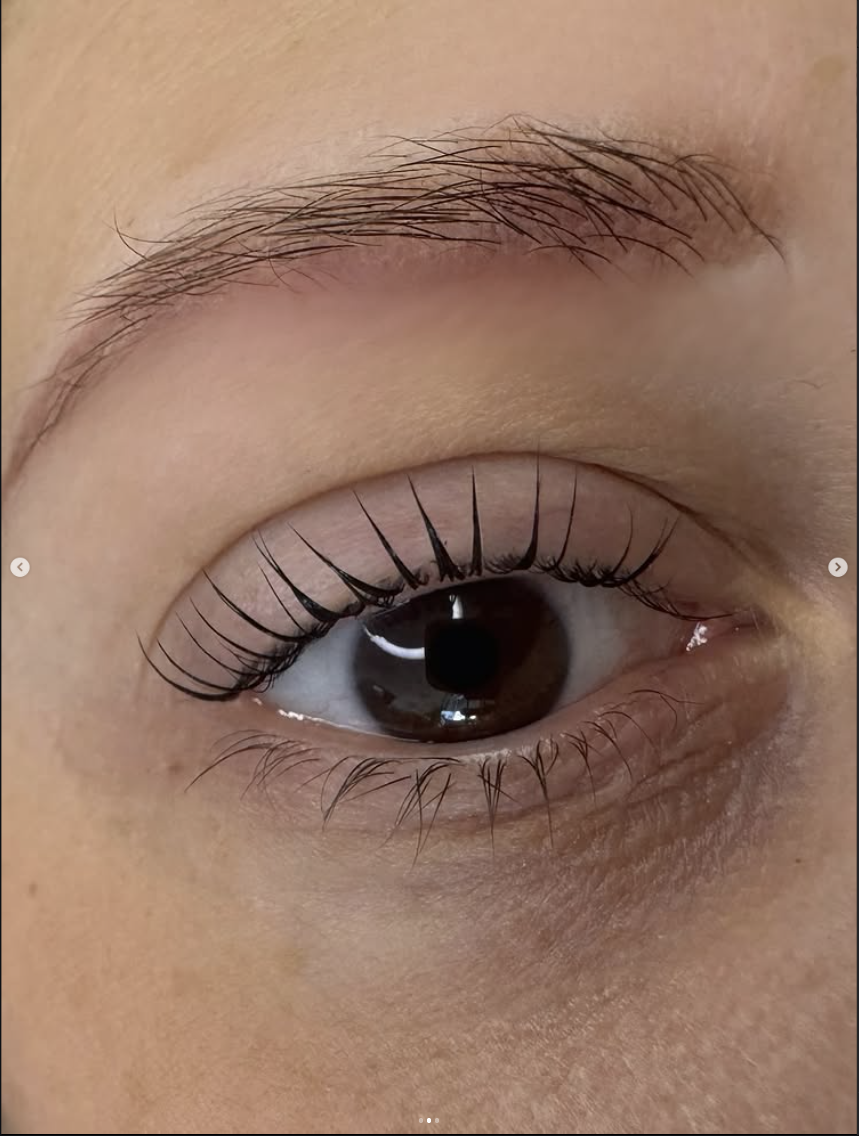 Effetto naturale — dopo