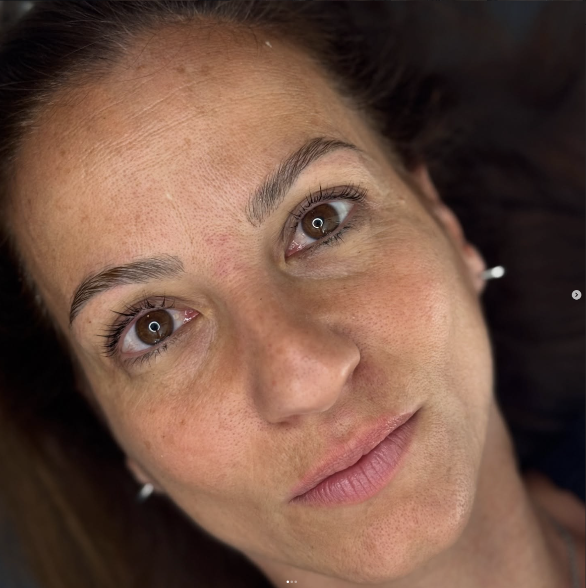 Sguardo più aperto — dopo